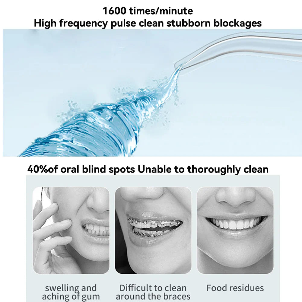 Sparkling Smile Water Flosser
