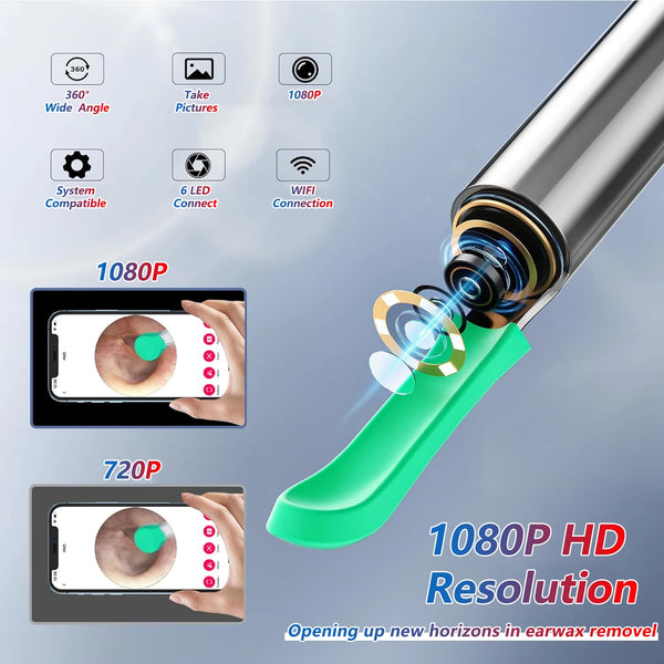 Smart-Visual-Ear-Cleaner-HD-Ear-Sticks-Otoscope-USB-C-Charging-Endoscope-Wax-Removal-Tool-Earpick.jpg