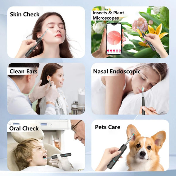 Smart-Visual-Ear-Cleaner-HD-Ear-Sticks-Otoscope-USB-C-Charging-Endoscope-Wax-Removal-Tool-Earpick.jpg